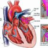 Bệnh tim mạch